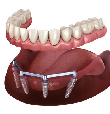 Dental Services