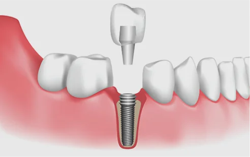 Dental 