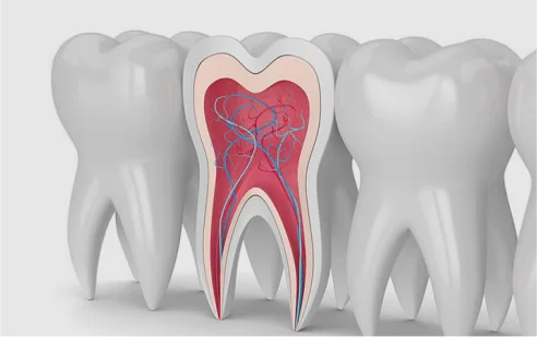 Retreatment of